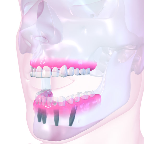 pro_arch_solution_uk0322_1
