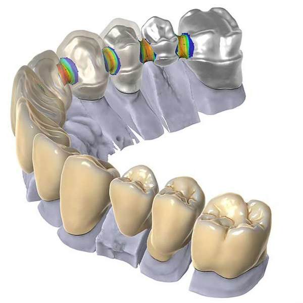 droessler-img-content-cadcam